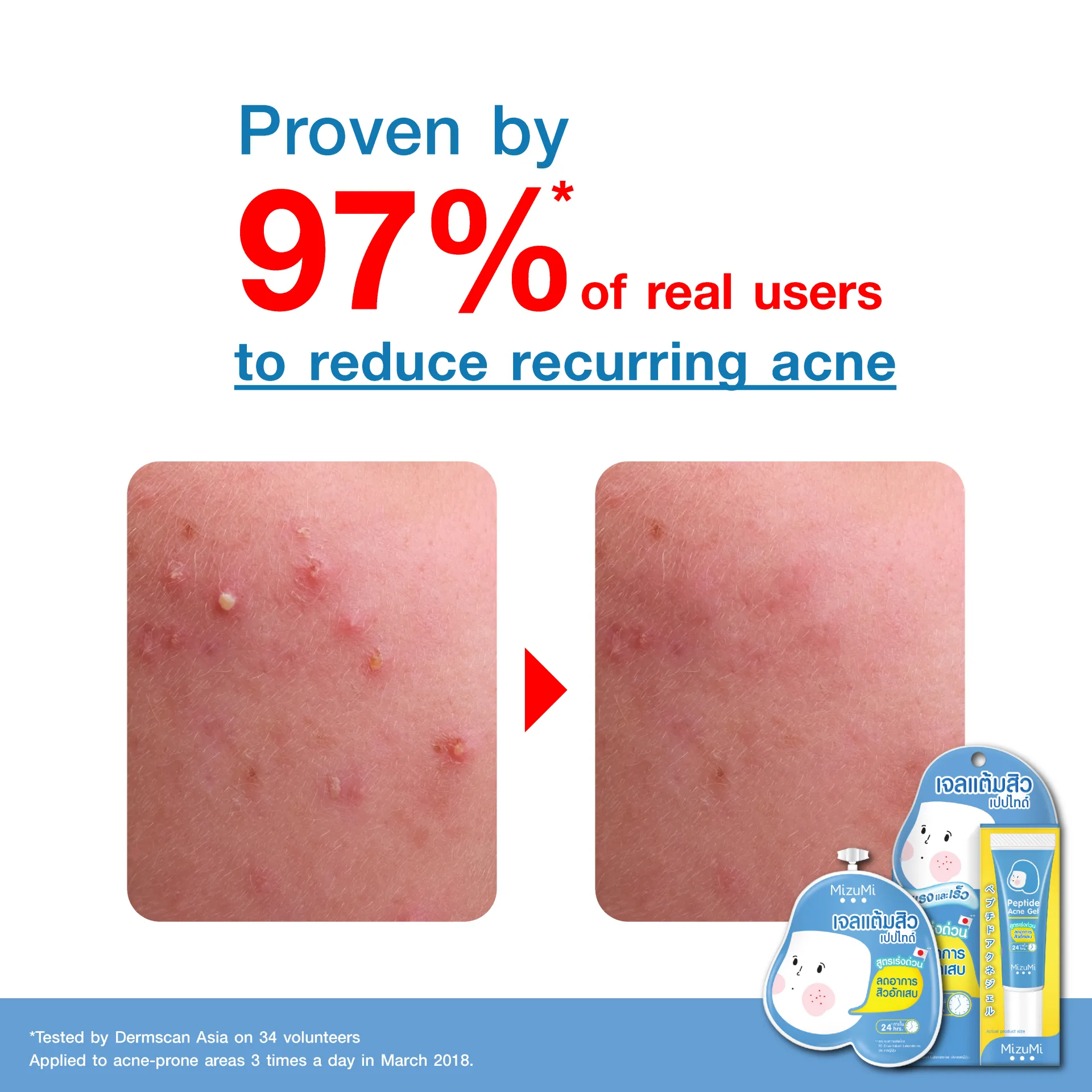 MizuMi Peptide Acne Gel